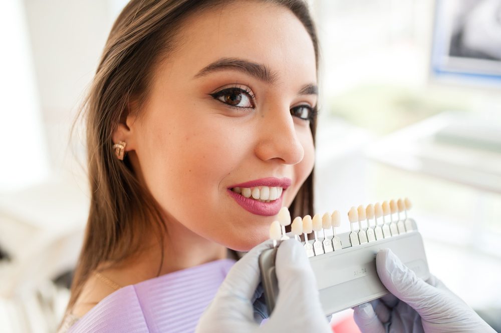 Blanqueamiento dental en consultorio en Cajicá