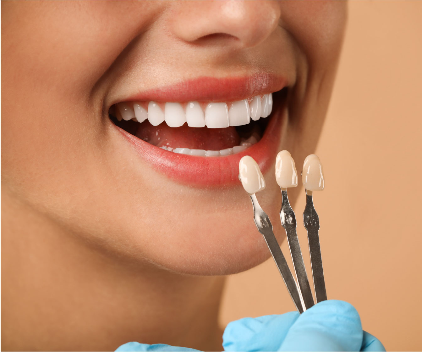 Blanqueamiento dental profesional en Cajicá